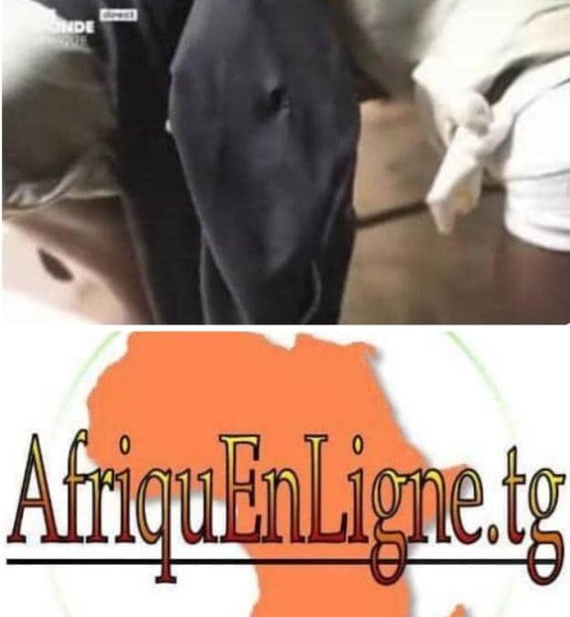 LE PRIX DU JOURNALISME : UN AN APRÈS L&rsquo;AGRESSION SAUVAGE DE YAWO KLOUSSE